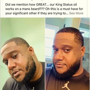 King status beard kit